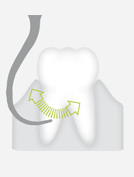W&H P2RD — Изогнутая вправо насадка с алмазным покрытием для обработки оголенных корней зуба