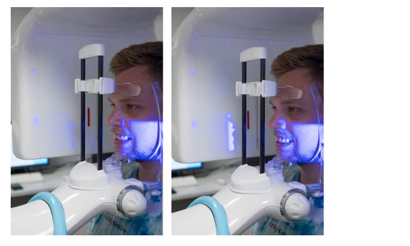 Критерии выбора конусно-лучевого компьютерного томографа.-07 (1).jpg
