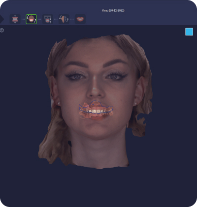 Автоматическое определение положения на основе AI.jpg