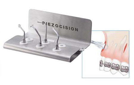 Acteon PiezoCision II – набор насадок (PZ1 II, PZ2L II, PZ2R II, PZ3 II) для Piezotome II