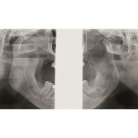 KaVo Pan eXam Plus 2D - датчик для панорамной рентгенодиагностики