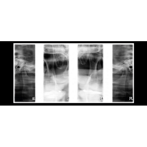Planmeca ProOne - универсальный цифровой ортопантомограф