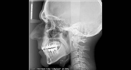 Owandy I-Max Touch 3D – Конусно-лучевой томограф 9х8