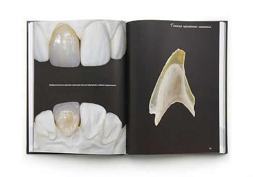 Эстетические стратегии в стоматологии. Искусство, наука и технологии. Стефано Инглезе